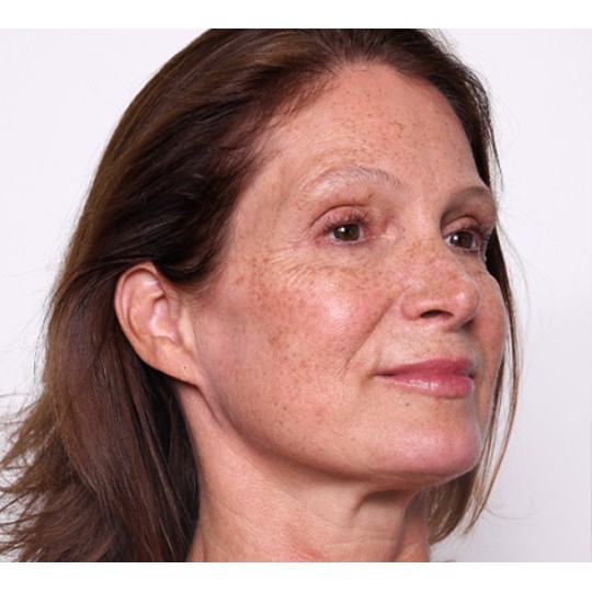 Micronutrition for Beautiful Skin - Level 3 (Hormones)| LB Facialistes