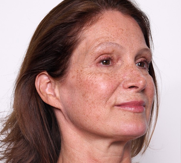 Micronutrition for Beautiful Skin - Level 3 (Hormones)| LB Facialistes