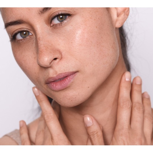 Accompagnement en micronutrition pour apaiser l'inflammation cutanée et les rougeurs du visage