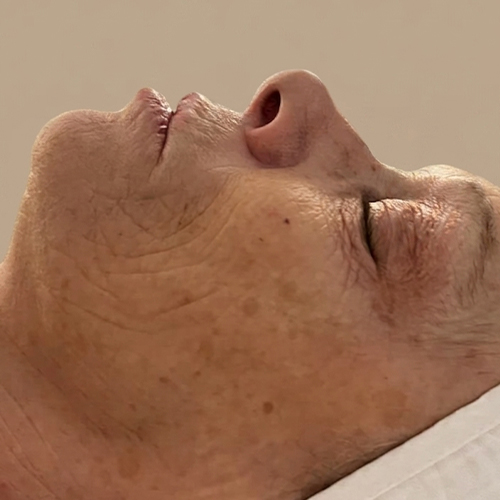 Massage Sur Mesure Méthode LB Facialistes© - Avant