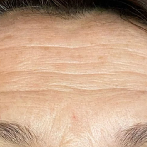 Massage Sur Mesure Méthode LB Facialistes© - Avant