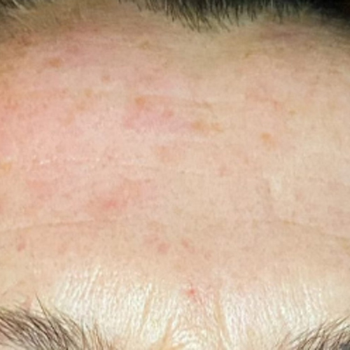 Massage Sur Mesure Méthode LB Facialistes© - Apres