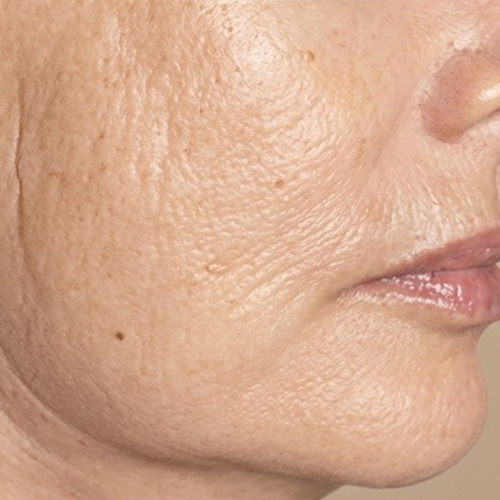 Massage Sur Mesure Méthode LB Facialistes© - Apres