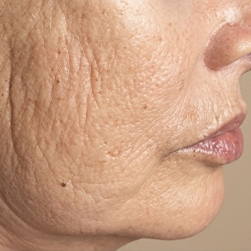 Massage Sur Mesure Méthode LB Facialistes© - Avant