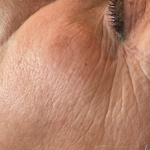 Massage Sur Mesure Méthode LB Facialistes© - Avant