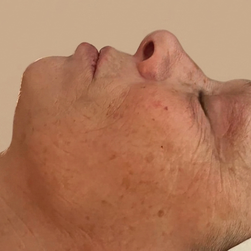 Massage Sur Mesure Méthode LB Facialistes© - Apres